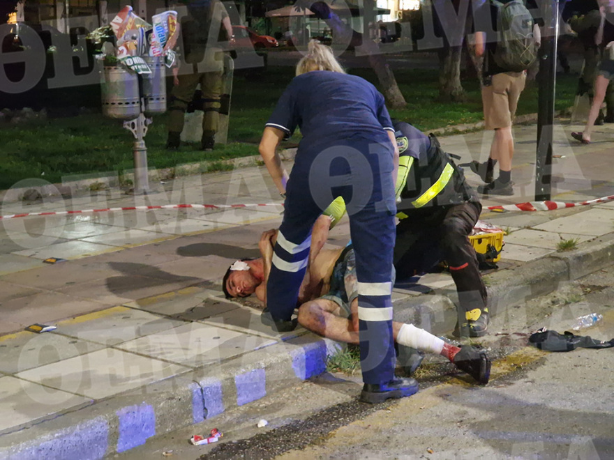 Θεσσαλονίκη: Άγριο επεισόδιο με μαχαιρώματα στο κέντρο της πόλης  - Δύο αλλοδαποί στο νοσοκομείο