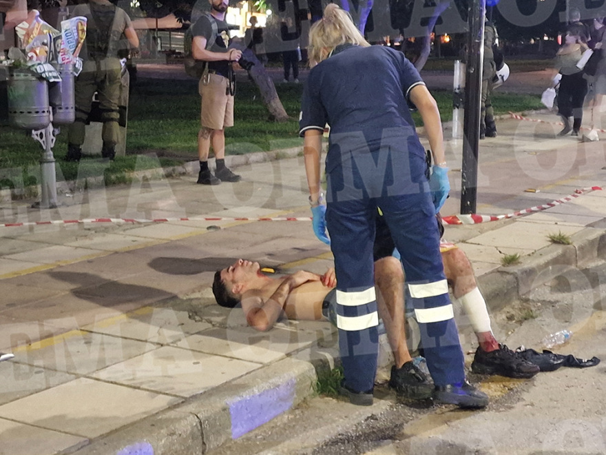 Θεσσαλονίκη: Άγριο επεισόδιο με μαχαιρώματα στο κέντρο της πόλης  - Δύο αλλοδαποί στο νοσοκομείο