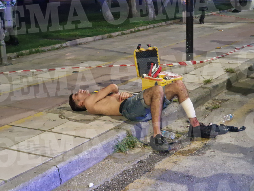 Θεσσαλονίκη: Άγριο επεισόδιο με μαχαιρώματα στο κέντρο της πόλης  - Δύο αλλοδαποί στο νοσοκομείο