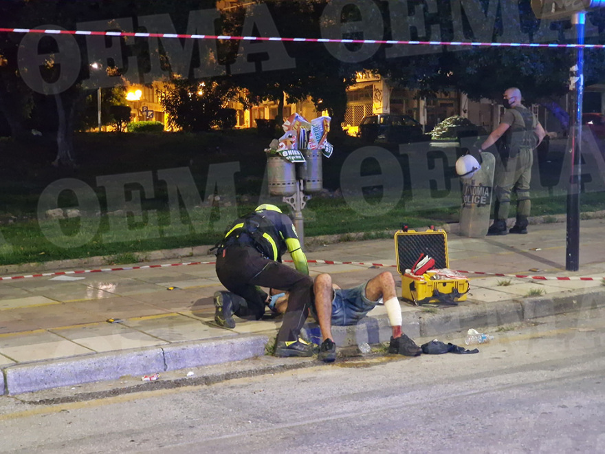 Θεσσαλονίκη: Άγριο επεισόδιο με μαχαιρώματα στο κέντρο της πόλης  - Δύο αλλοδαποί στο νοσοκομείο