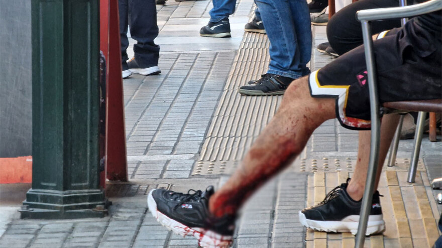 Πυροβολισμοί με έναν τραυματία στη Θεσσαλονίκη