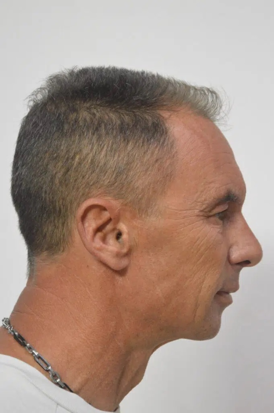 Πάτρα: Αυτός είναι ο 51χρονος που κατηγορείται για αποπλάνηση 14χρονης