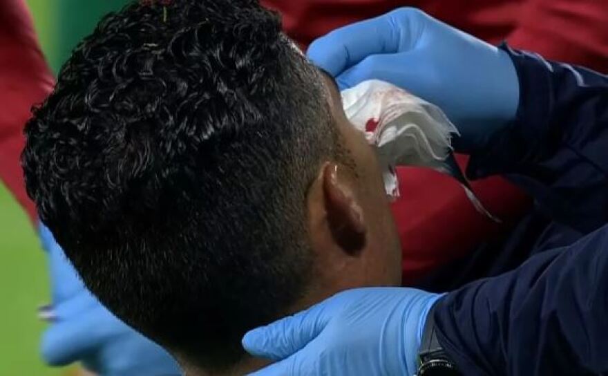  Τσεχία - Πορτογαλία: Τρομερή σύγκρουση στον αέρα του Βατσλίκ με τον Ρονάλντο 