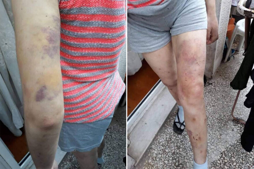 Ο μαρτυρικός βίος της 23χρονης Φαίης Μπακογιώργου - Συγκλονίζει η κατάθεση του πατέρα