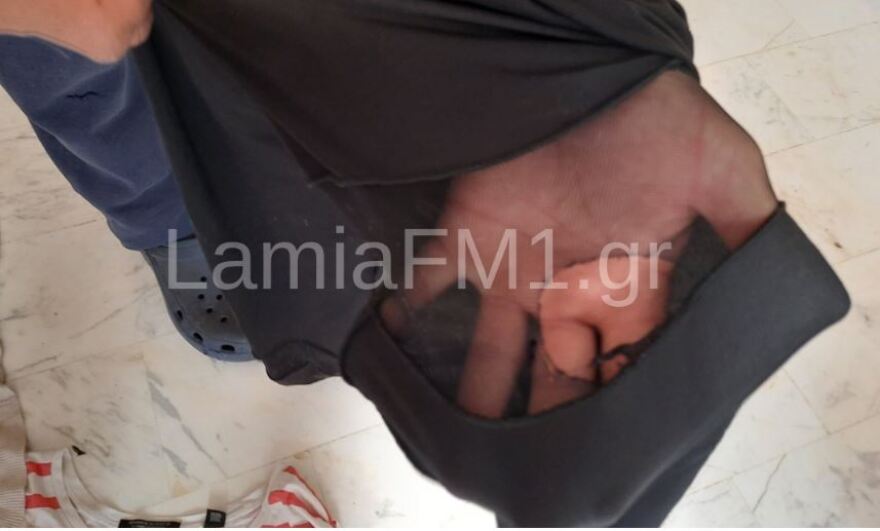 Λαμία: «Mε άρπαξε και με χτυπούσε στο πεζοδρόμιο» λέει η 35χρονη που δέχτηκε επίθεση σκύλου