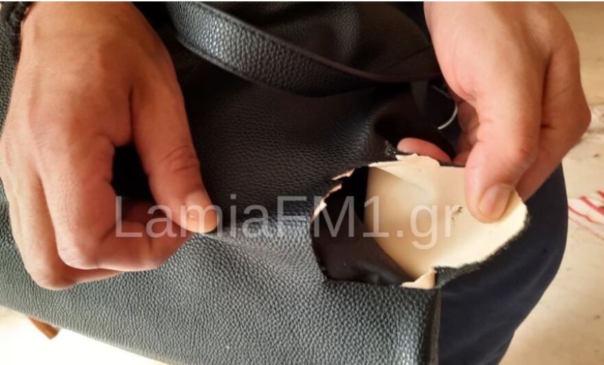 Λαμία: «Mε άρπαξε και με χτυπούσε στο πεζοδρόμιο» λέει η 35χρονη που δέχτηκε επίθεση σκύλου