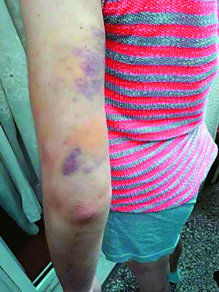 Το «Χαμόγελο του Παιδιού» είχε ενημερώσει για την «κόλαση» της Φαίης