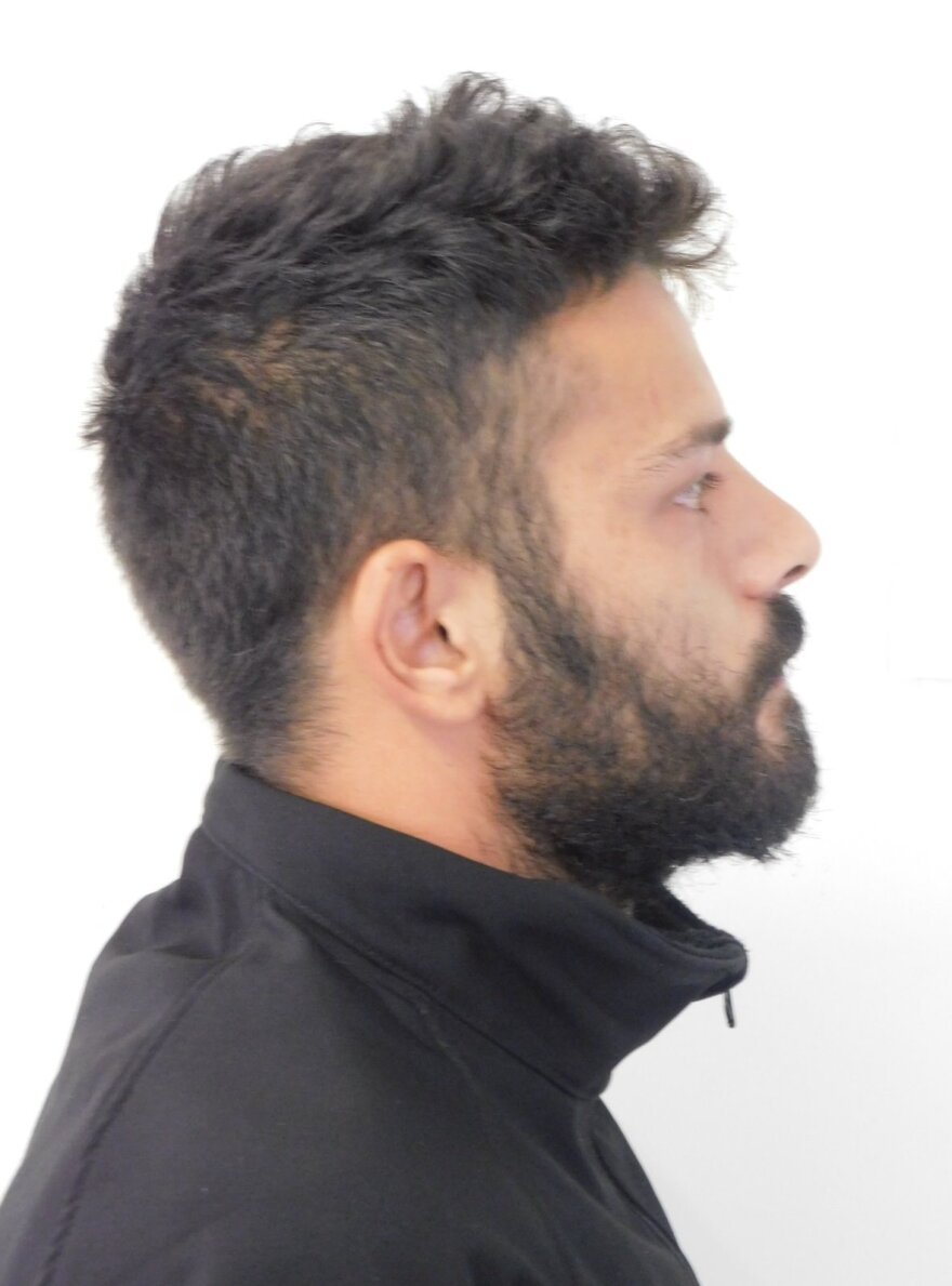 Χαλκιδική: Στη δημοσιότητα τα στοιχεία του 24χρονου κατηγορούμενου για τον βιασμό ανήλικης