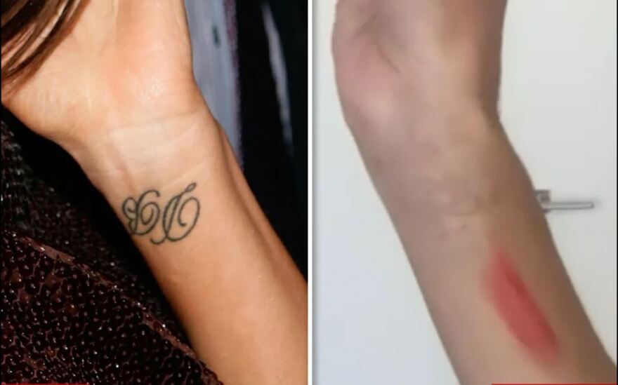 Μπέκαμ: Η Βικτόρια έσβησε τατουάζ με τα αρχικά του συζύγου της