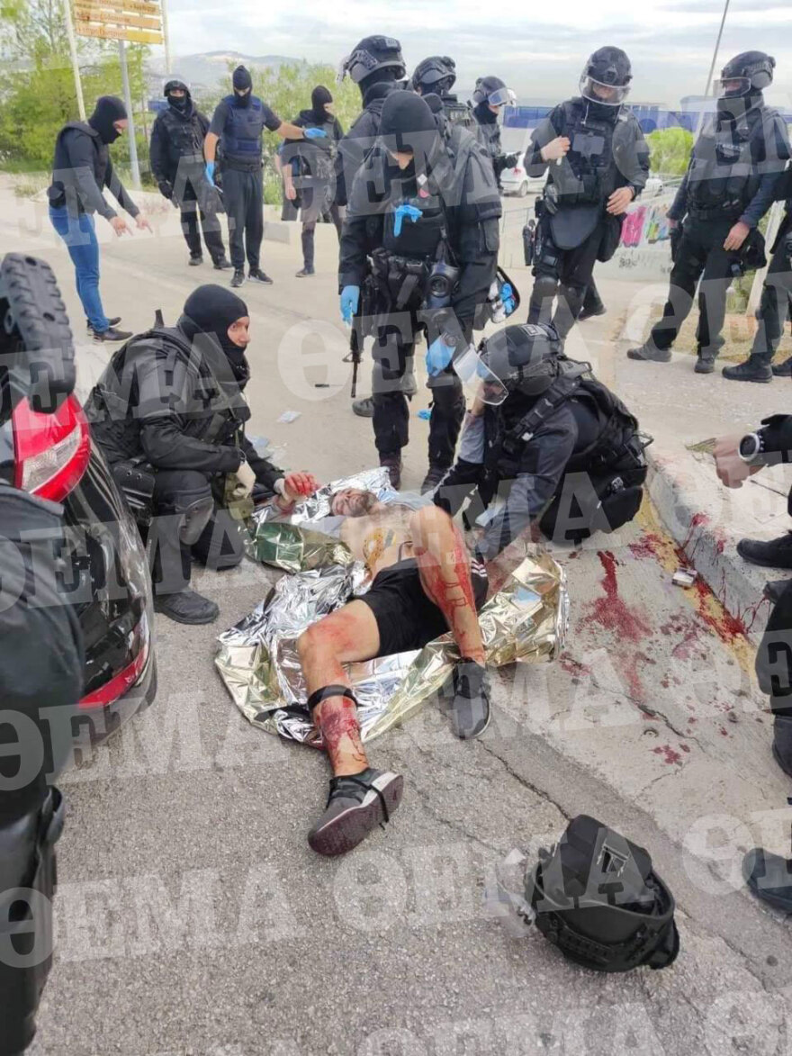 Πολυτεχνειούπολη Ζωγράφου: Ο Αλβανός κακοποιός δέχεται τις πρώτες βοήθειες από τους άνδρες των ΕΚΑΜ - Φωτογραφία-ντοκουμέντο