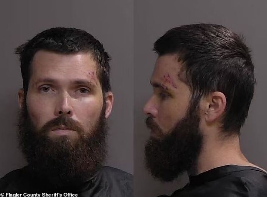 Φλόριντα: Πατέρας έβαλε ασπίδα το 1 έτους παιδί του για να μην συλληφθεί πριν τον χτυπήσουν με taser - Δείτε βίντεο