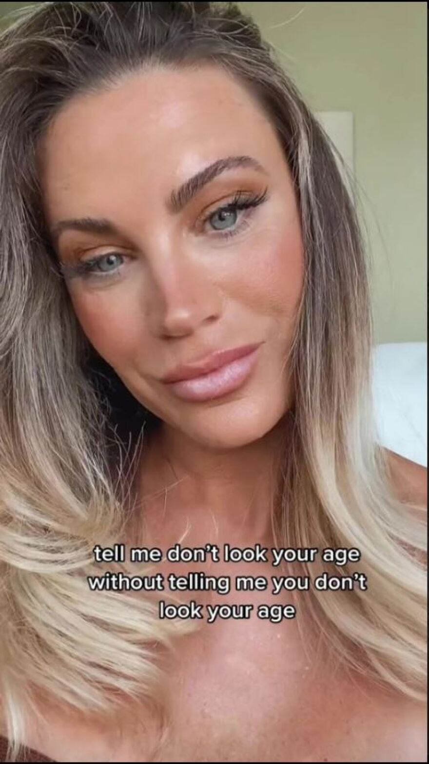 45χρονη κάνει μπότοξ για να μοιάζει με 30 αλλά trolls λένε ότι η ηλικία της φαίνεται