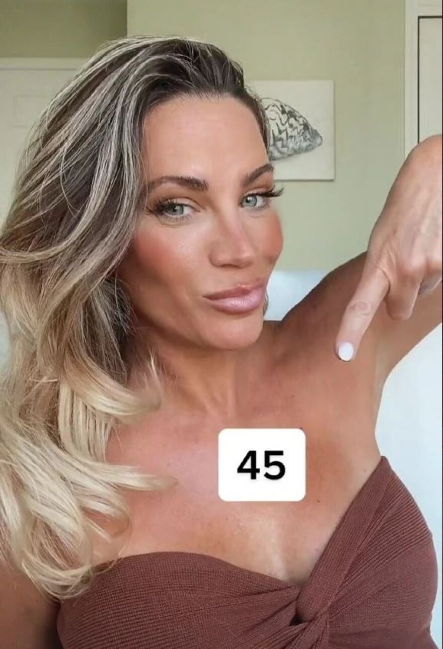 45χρονη κάνει μπότοξ για να μοιάζει με 30 αλλά trolls λένε ότι η ηλικία της φαίνεται