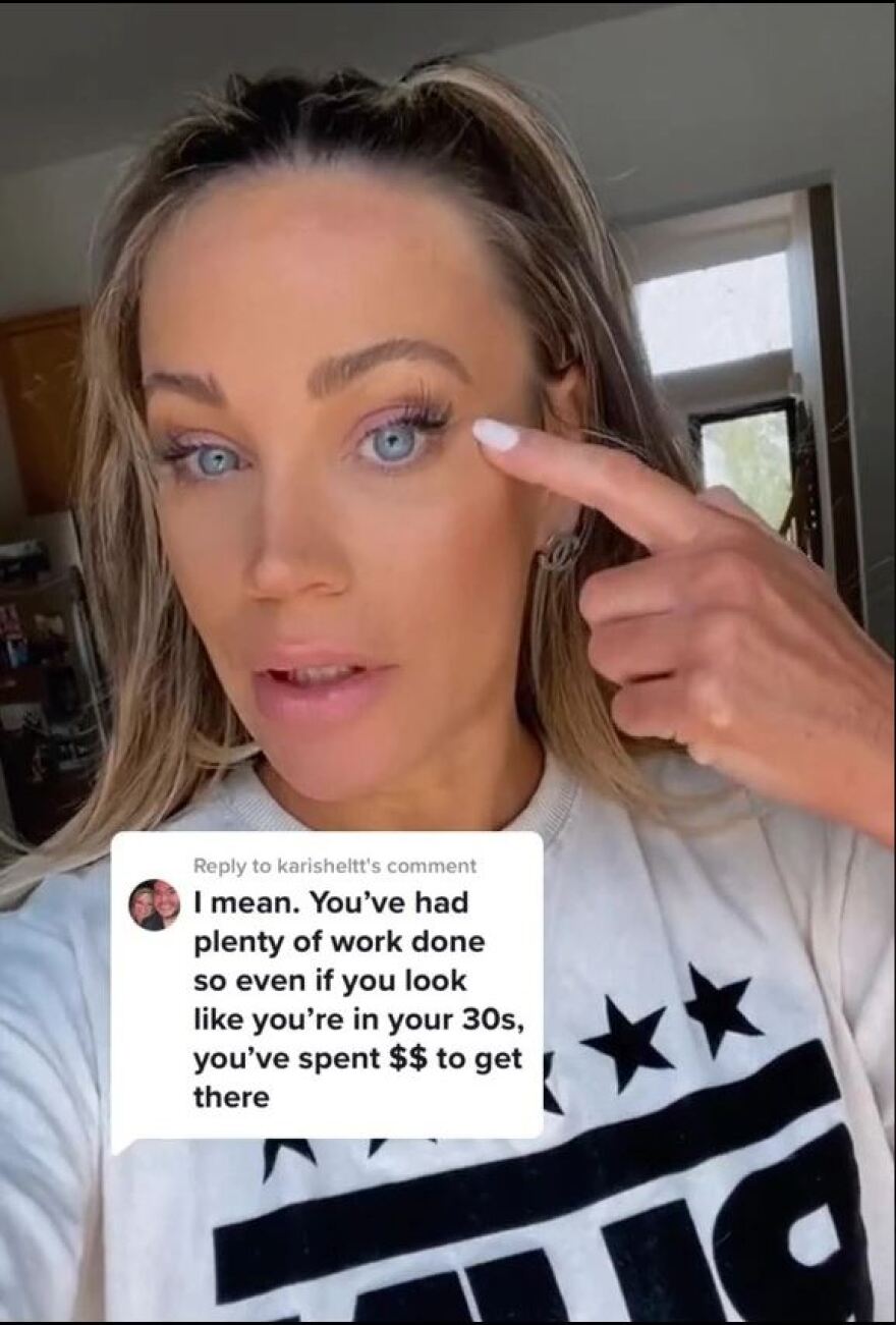 45χρονη κάνει μπότοξ για να μοιάζει με 30 αλλά trolls λένε ότι η ηλικία της φαίνεται