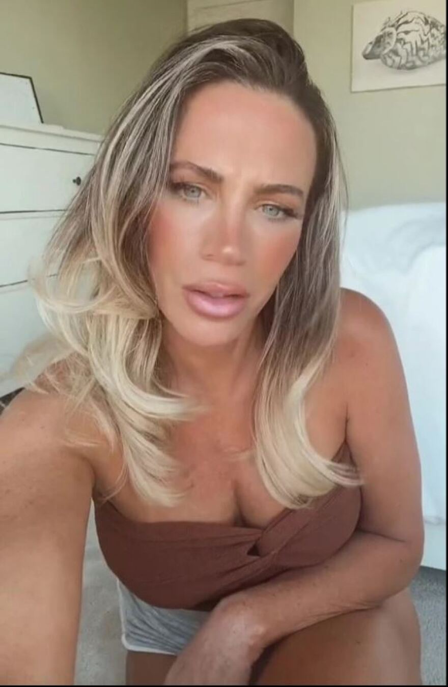 45χρονη κάνει μπότοξ για να μοιάζει με 30 αλλά trolls λένε ότι η ηλικία της φαίνεται