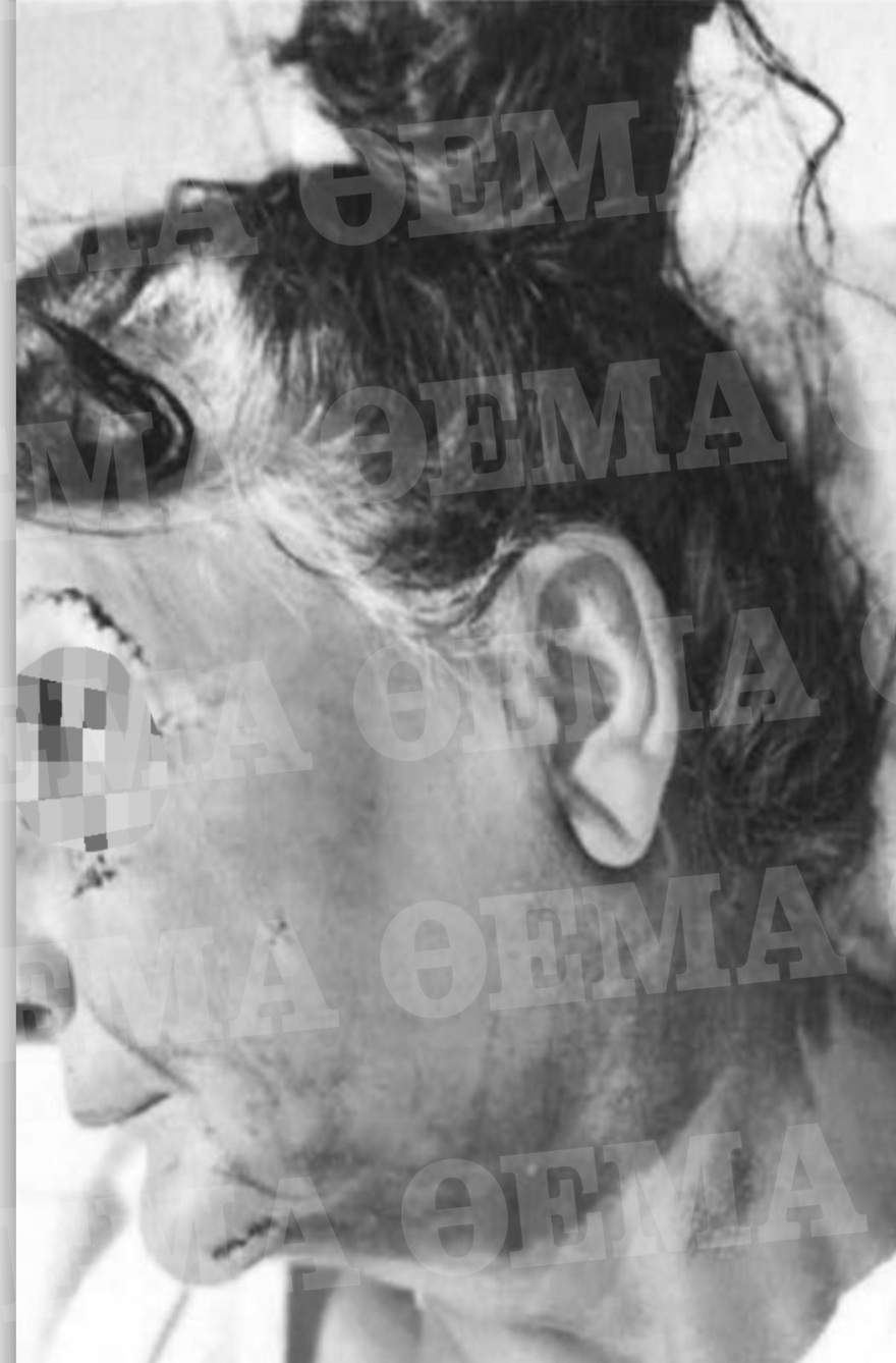 Αίγινα: Όλη η δικογραφία για τον ξυλοδαρμό μητέρας και γιου