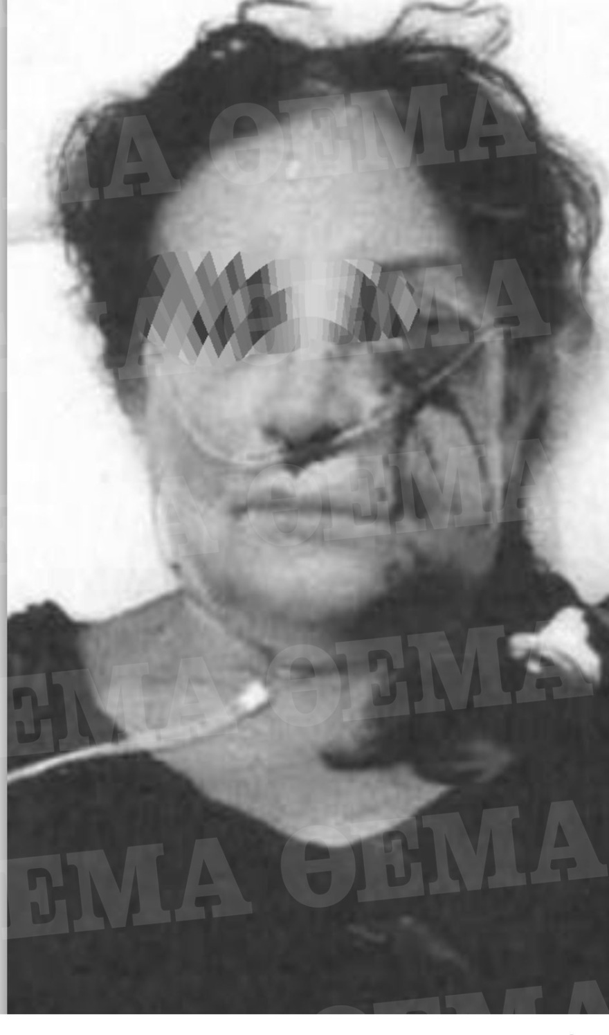 Αίγινα: Όλη η δικογραφία για τον ξυλοδαρμό μητέρας και γιου