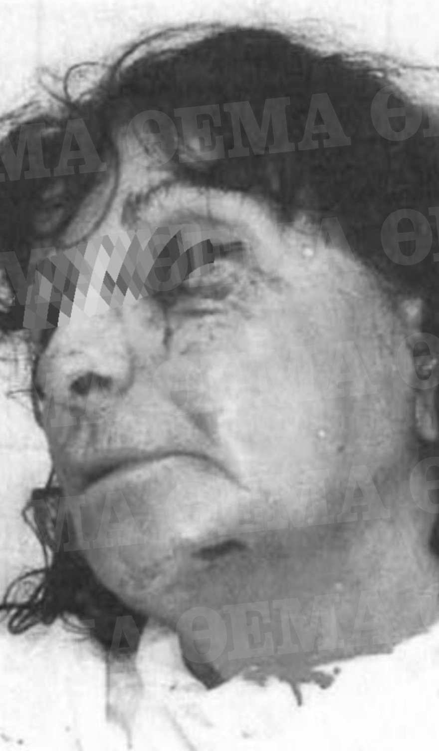 Αίγινα: Φωτογραφίες-ντοκουμέντο από τον άγριο ξυλοδαρμό του ξενοδόχου