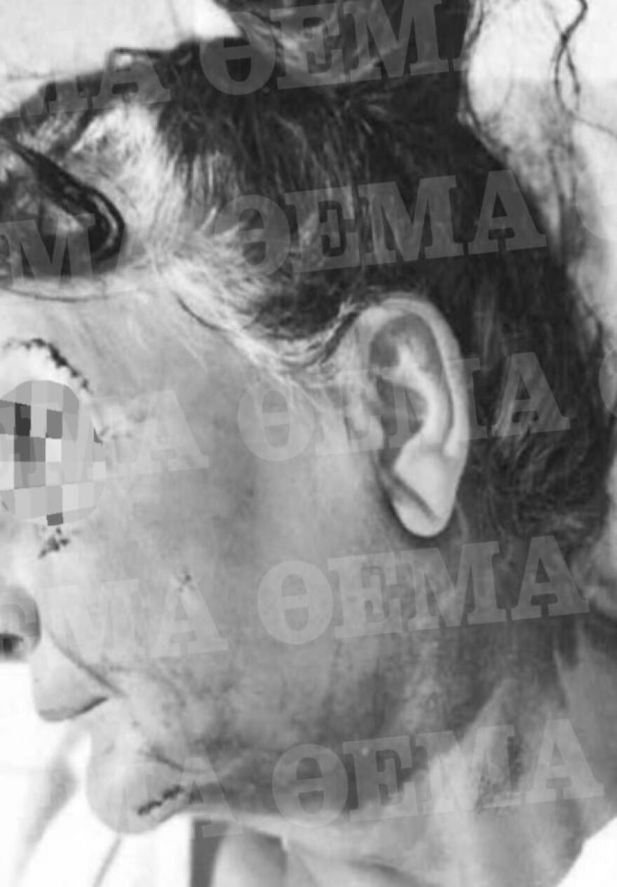 Αίγινα: Βίντεο-ντοκουμέντο από τον άγριο ξυλοδαρμό του ξενοδόχου και της 67χρονης μητέρας του