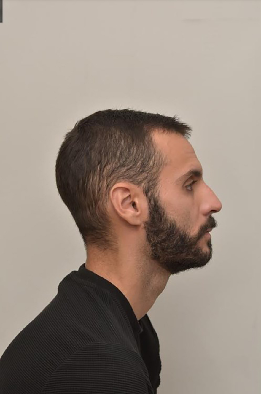 Αγρίνιο: Αυτός είναι ο 28χρονος που ασελγούσε σε 4χρονο αγοράκι