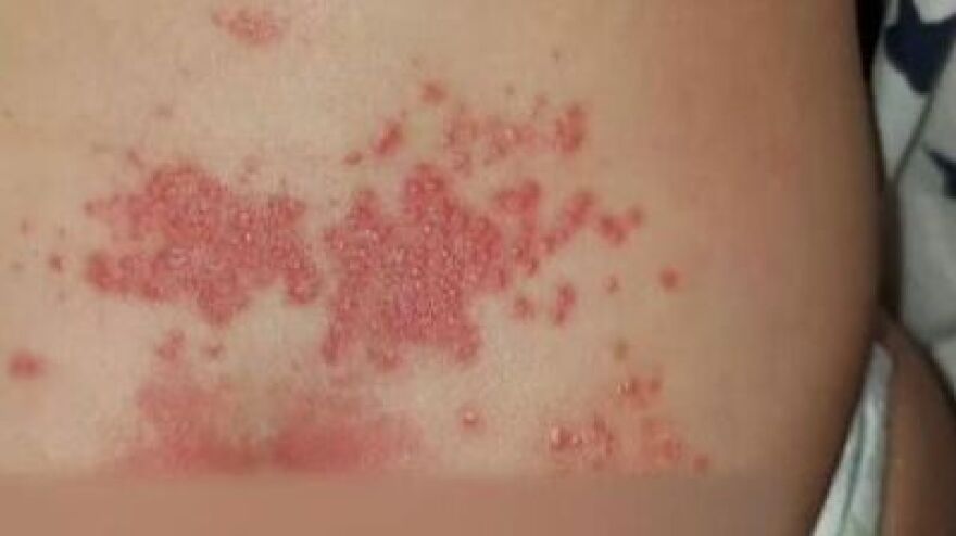 Καταγγελίες για βρεφονηπιακό σταθμό - «Άφηναν τα παιδιά νηστικά, περπατούσαν κατσαρίδες πάνω τους»