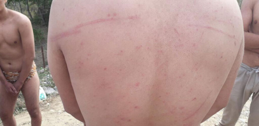 Μαρτυρίες για την «εισβολή των γυμνών» στον Έβρο: Οι Τούρκοι μας χτύπησαν και μας έγδυσαν