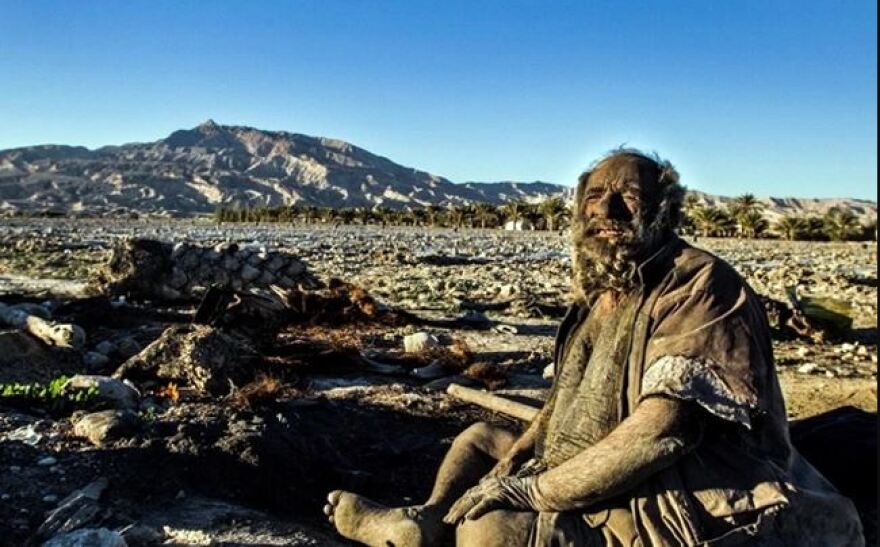Πέθανε σε ηλικία 94 ετών ο «πιο βρόμικος άνθρωπος στον κόσμο» - Είχε να πλυθεί πάνω από 50 χρόνια