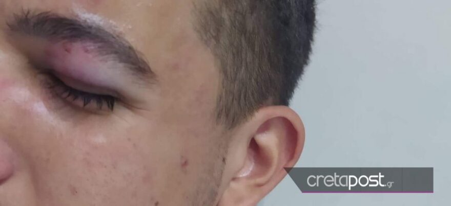 Οδηγός ξυλοκόπησε μαθητή επειδή του έκανε παρατήρηση για τη διάβαση πεζών