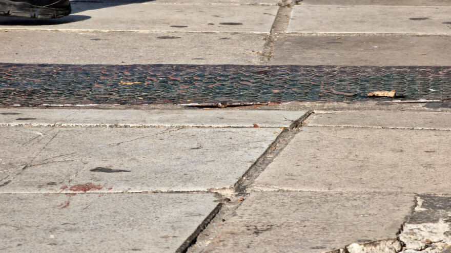 Θεσσαλονίκη: Δεν είναι πλαστικός χειρουργός ο γιατρός που χτυπήθηκε με λοστό στο κεφάλι