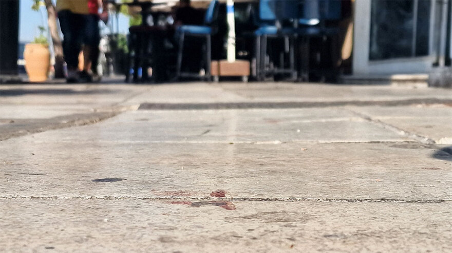 Θεσσαλονίκη: Δεν είναι πλαστικός χειρουργός ο γιατρός που χτυπήθηκε με λοστό στο κεφάλι