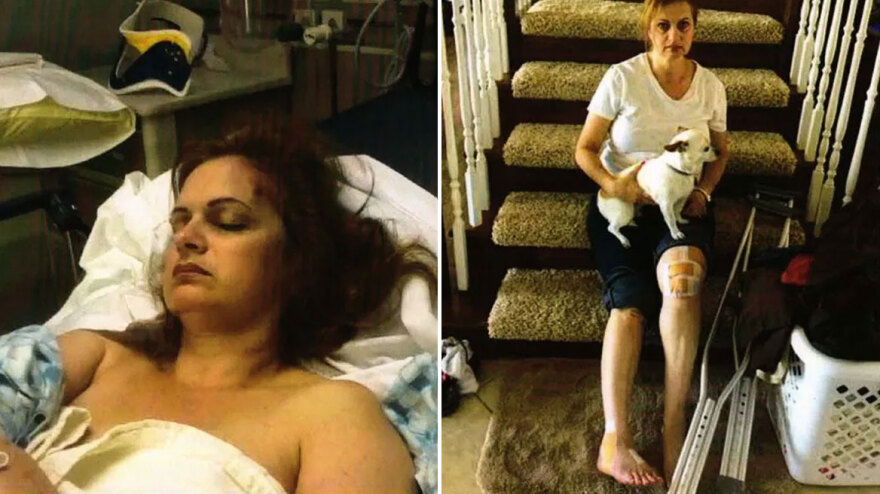 Πόσα κόκαλα θα έσπαγες για 6 εκατ. δολάρια; Οικογένεια έκανε επάγγελμα τις ασφαλιστικές απάτες