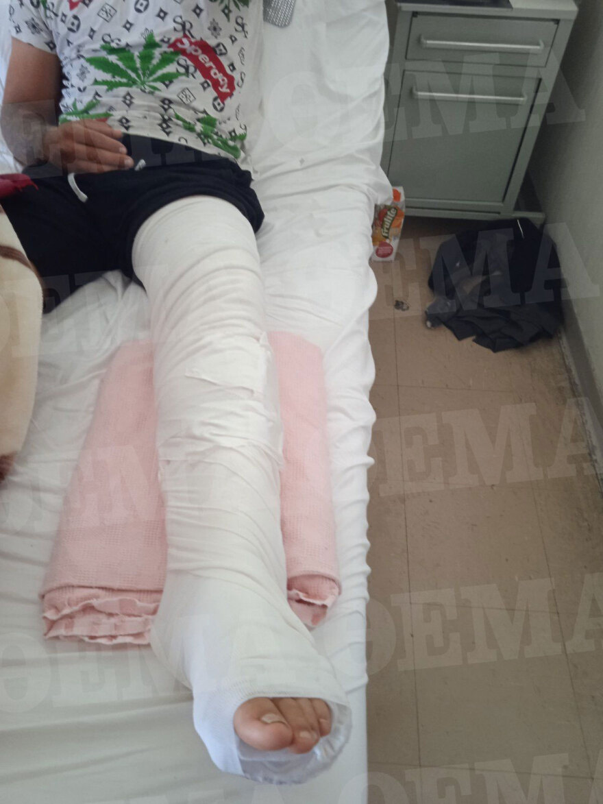 Λιόσια: «Τώρα θα σε σκοτώσουμε» - Η συγκλονιστική μαρτυρία του 23χρονου που πυροβολήθηκε