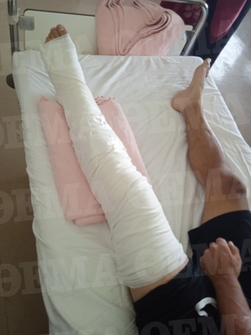 Λιόσια: «Τώρα θα σε σκοτώσουμε» - Η συγκλονιστική μαρτυρία του 23χρονου που πυροβολήθηκε