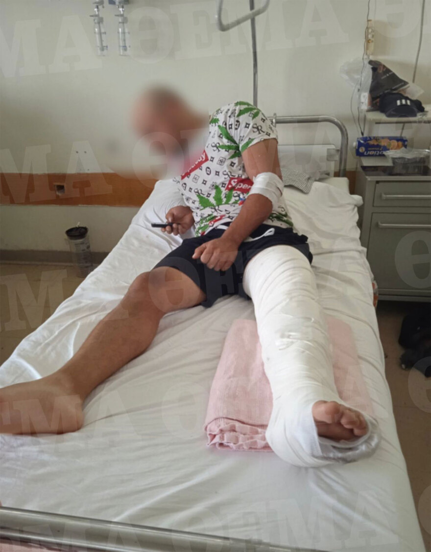 Λιόσια: «Τώρα θα σε σκοτώσουμε» - Η συγκλονιστική μαρτυρία του 23χρονου που πυροβολήθηκε