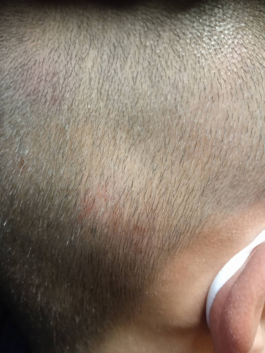 Θεσσαλονίκη: «Τον χτυπούσαν με κλωτσιές και μπουνιές» λέει ο πατέρας του 15χρονου που του επιτέθηκαν σε ΕΠΑΛ