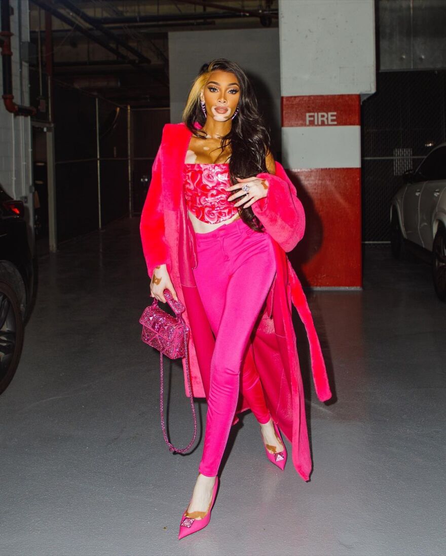 Γουίνι Χάρλοου: Το μοντέλο με τη λεύκη «φλερτάρει» σταρ του NBA εν μέσω αγώνα - «Το νούμερο 33 να μου τηλεφωνήσει»