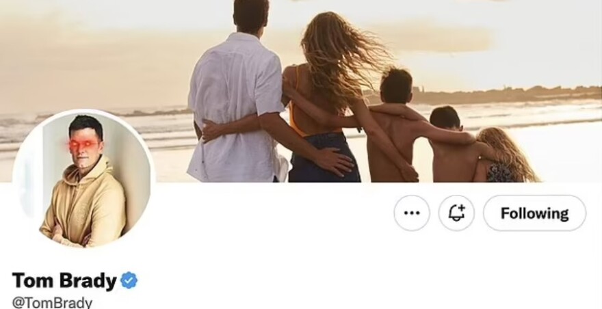 Ζιζέλ: Ο Τομ Μπρέιντι την κατηγορεί ότι τον απάτησε με τον δάσκαλο του ζίου-ζίτσου