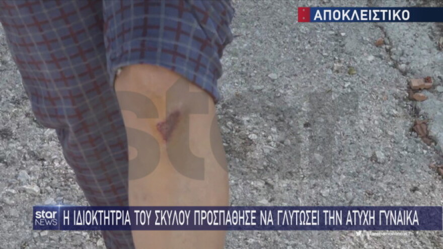 Χαλάνδρι: Γυναίκα που έκανε τζόκινγκ δέχθηκε άγρια επίθεση από σκύλο - «Μου έφυγε το κρέας»
