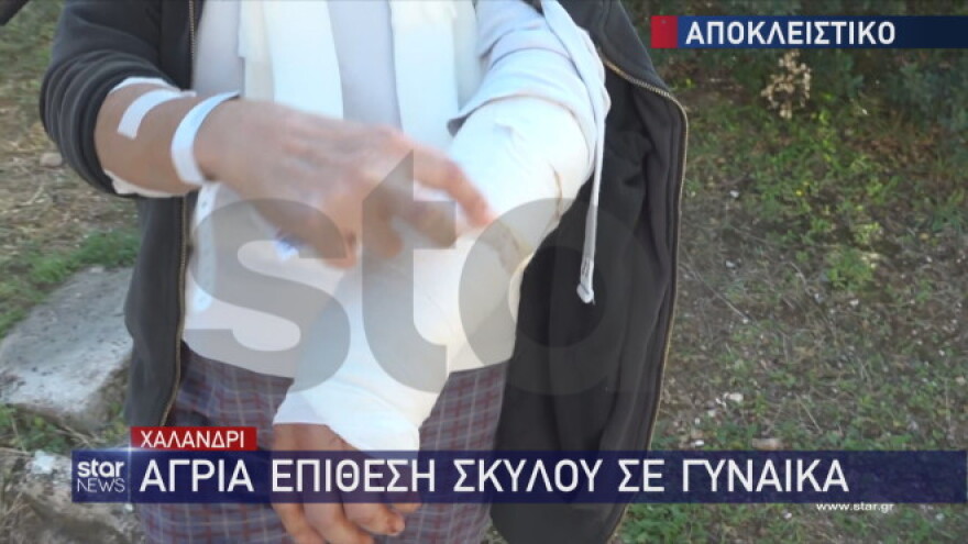 Χαλάνδρι: Γυναίκα που έκανε τζόκινγκ δέχθηκε άγρια επίθεση από σκύλο - «Μου έφυγε το κρέας»