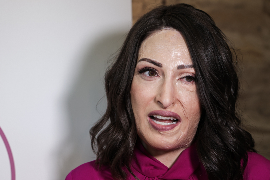 Ιωάννα Παλιοσπύρου: Επέστρεψε στο σημείο που δέχτηκε την επίθεση με βιτριόλι - «Εδώ ξεκίνησε για μένα μια άλλη ζωή»