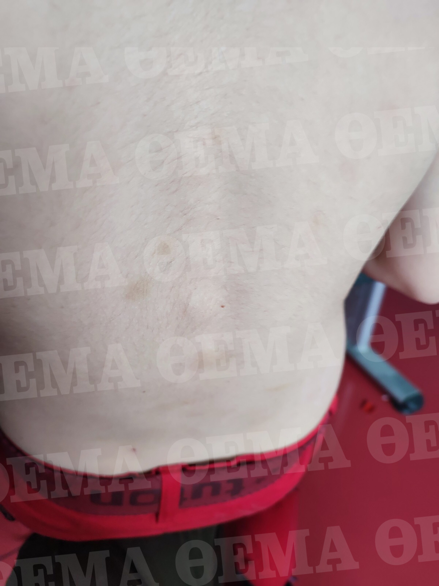 Κιβωτός του Κόσμου: 8χρονος περιγράφει την κακοποίησή του - «Με έβαλαν στο κλουβί για τα παπαγαλάκια» 