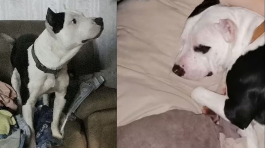 Νέα Υόρκη: Έφηβη παραλίγο να χάσει το πόδι της από επίθεση πίτμπουλ 