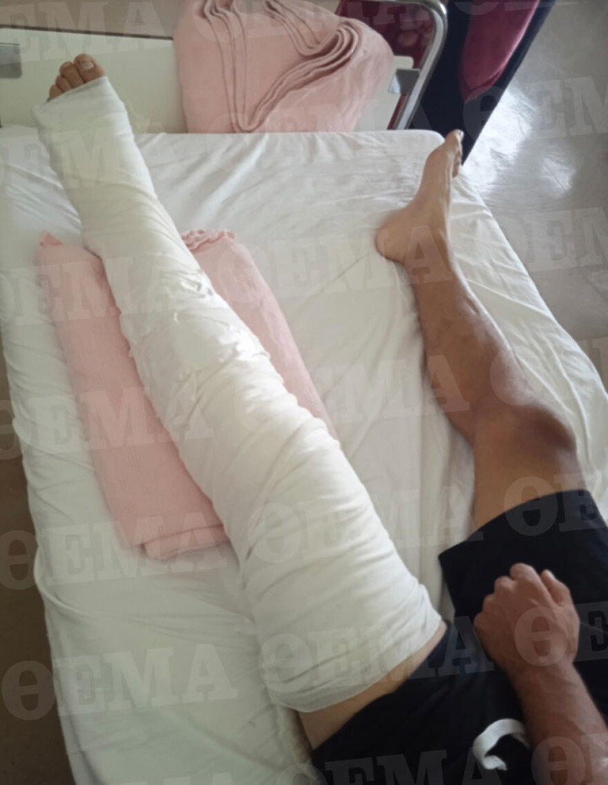 Επίθεση στα Λιόσια: Με πατερίτσες κατέθεσε ο 23χρονος που πυροβολήθηκε εν ψυχρώ