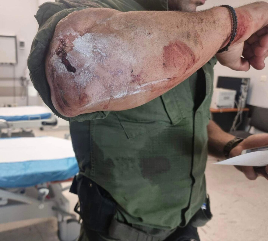 Θεσσαλονίκη: «Βομβαρδισμένο» τοπίο μετά τα επεισόδια - Στο χειρουργείο αστυνομικός