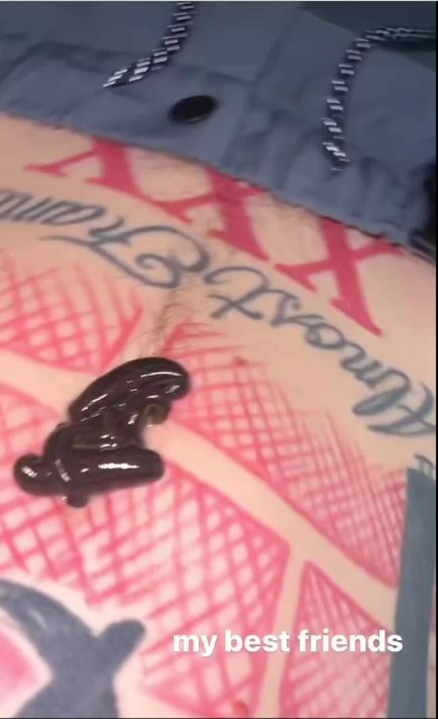 Μασίν Γκαν Κέλι: Έβαλε βδέλλες στο σώμα του