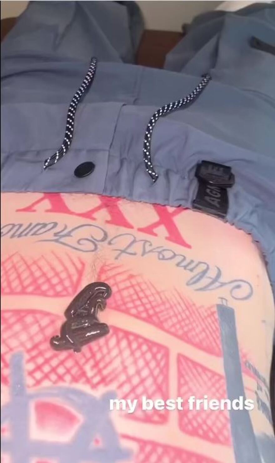 Μασίν Γκαν Κέλι: Έβαλε βδέλλες στο σώμα του