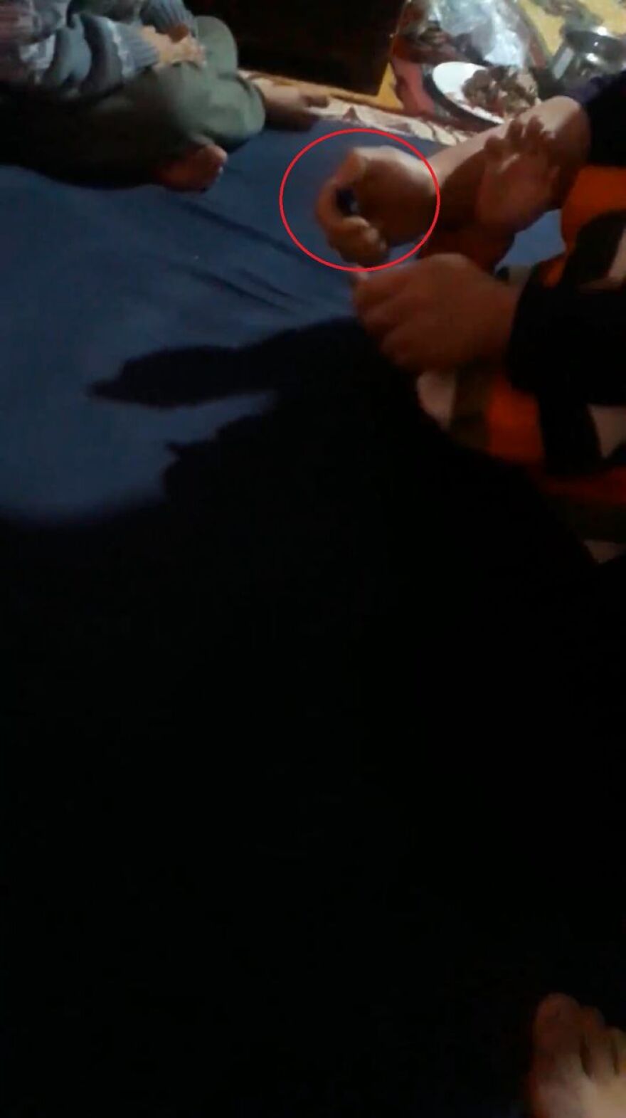 Τουρκία: Γονείς-τέρατα στην Προύσα έκλειναν με ταινία το στόμα των παιδιών τους και τα έκαιγαν με αναπτήρα