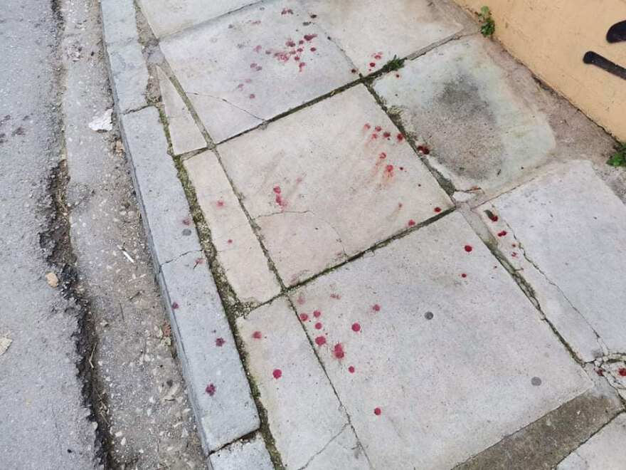 Γιατί βγήκαν τα μαχαίρια στη συμπλοκή ανηλίκων στο Χαλάνδρι - Στο νοσοκομείο δύο 17χρονοι