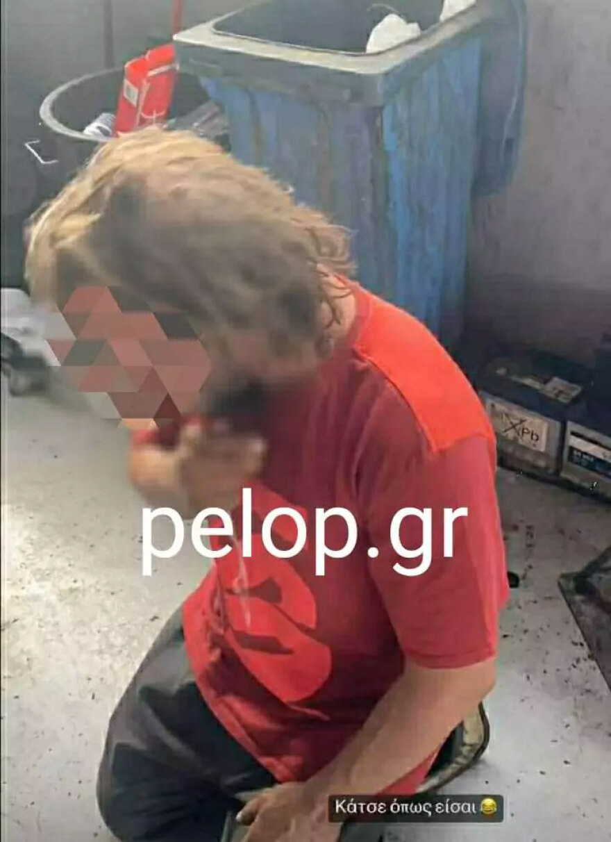 «Μόνος μου γονάτισα, η φωτιά ήταν καλαμπούρι», λέει ο 35χρονος Ρομά από την Πάτρα