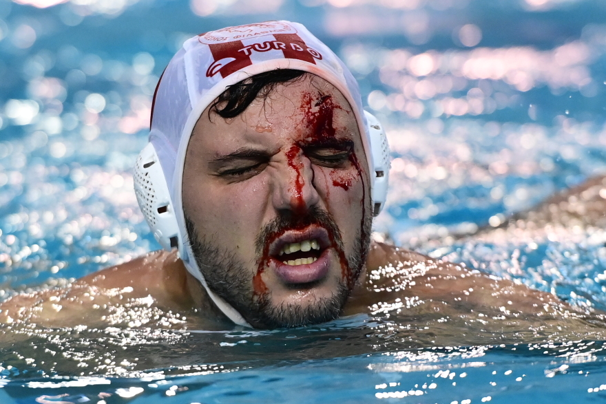 Χτυπήθηκε στο πρόσωπο ο Μουρίκης και αποχώρησε ματωμένος από το Ολυμπιακός - Μπαρτσελονέτα - Δείτε βίντεο 